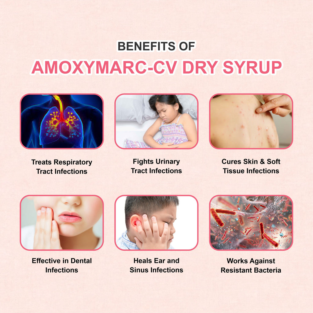 Amoxymarc CV Dry Syrup – Effective Pediatric Antibiotic for Bacterial Infections(Pack of 4)