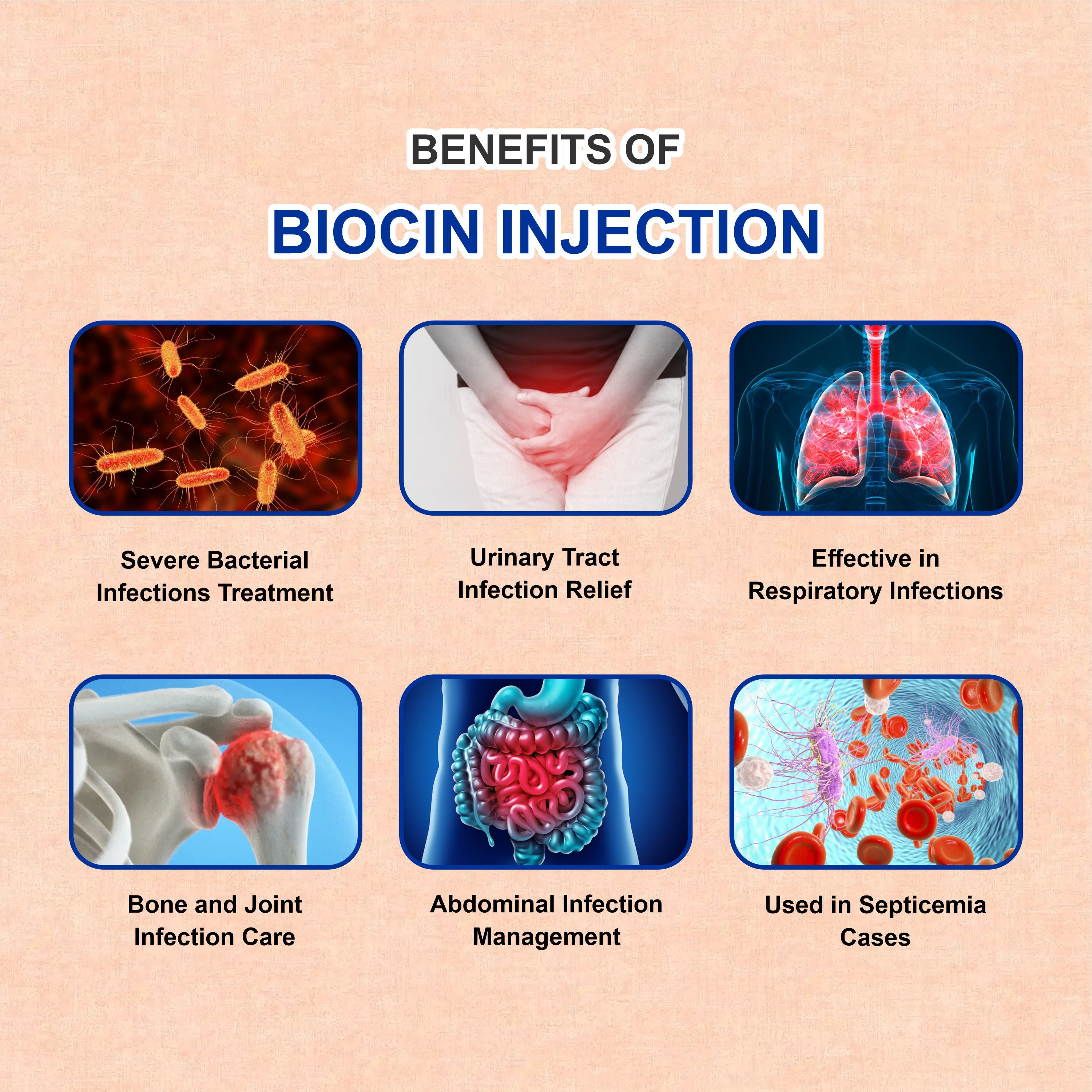 Biocin Injection 500mg – Aminoglycoside Antibiotic for Serious Bacterial Infections