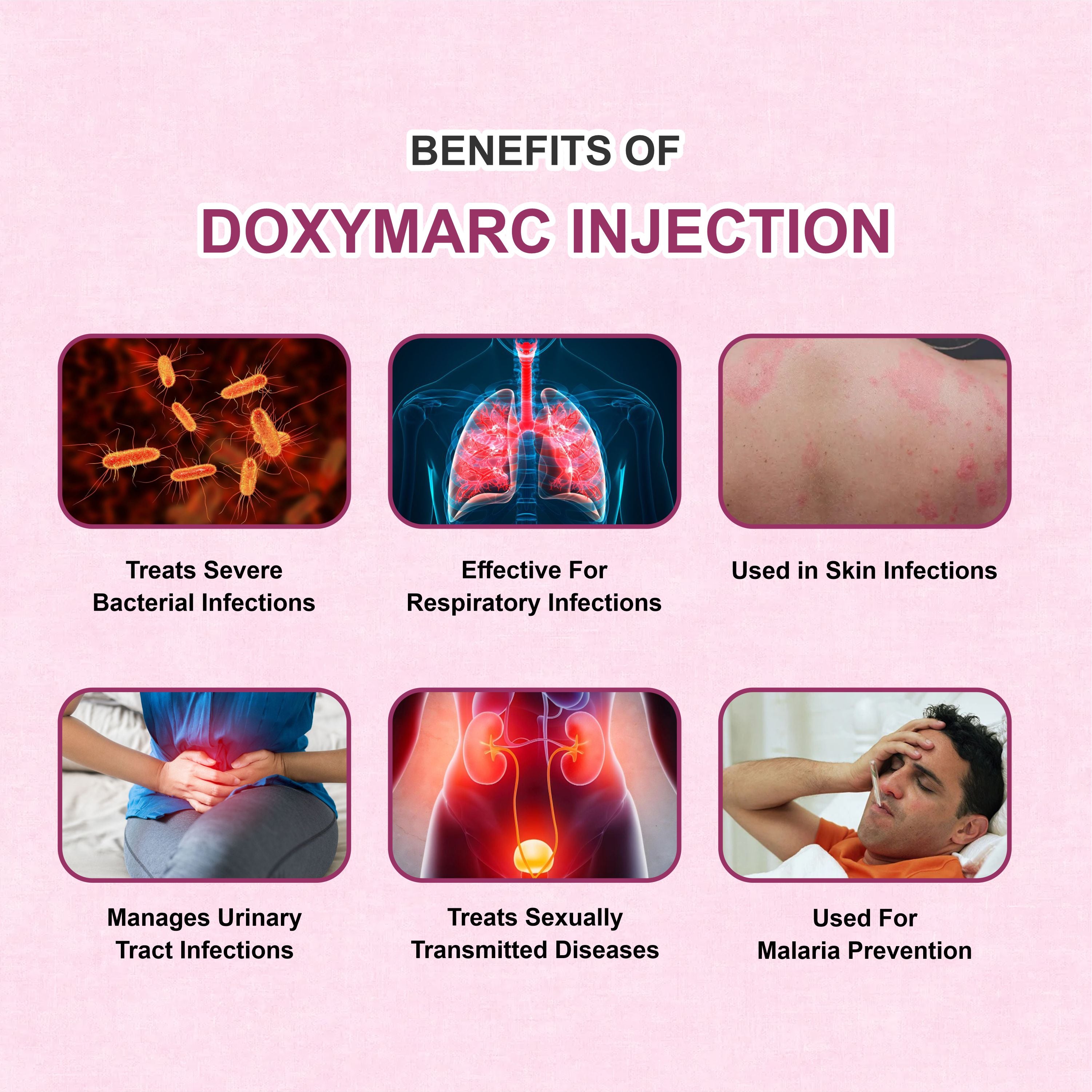 Doxymarc Injection – Powerful Broad-Spectrum Antibiotic for Severe Infections