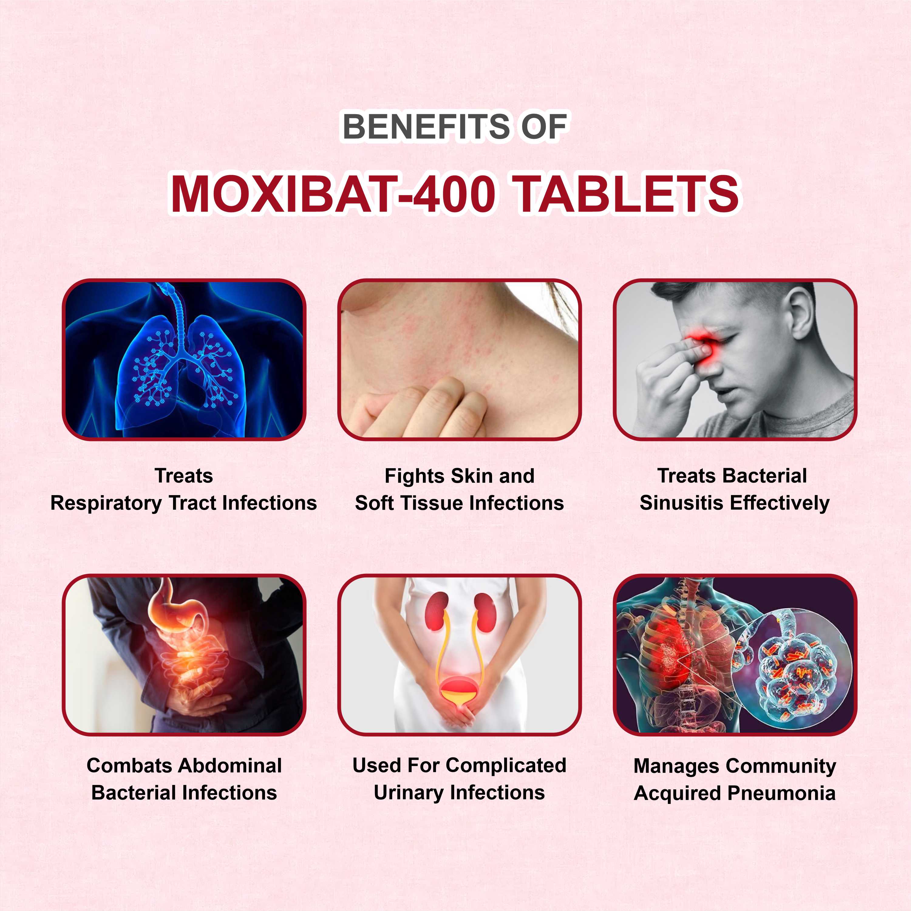 Moxibat 400 Tablet – Powerful Protection Against Bacterial Infections