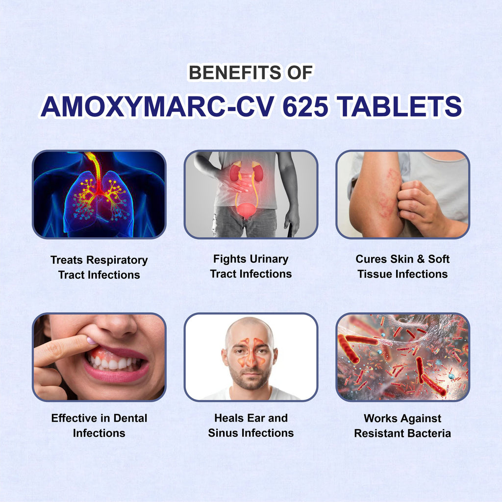 Amoxymarc CV Tablet – Powerful Antibiotic Combination for Faster Infection Relief(1Box)
