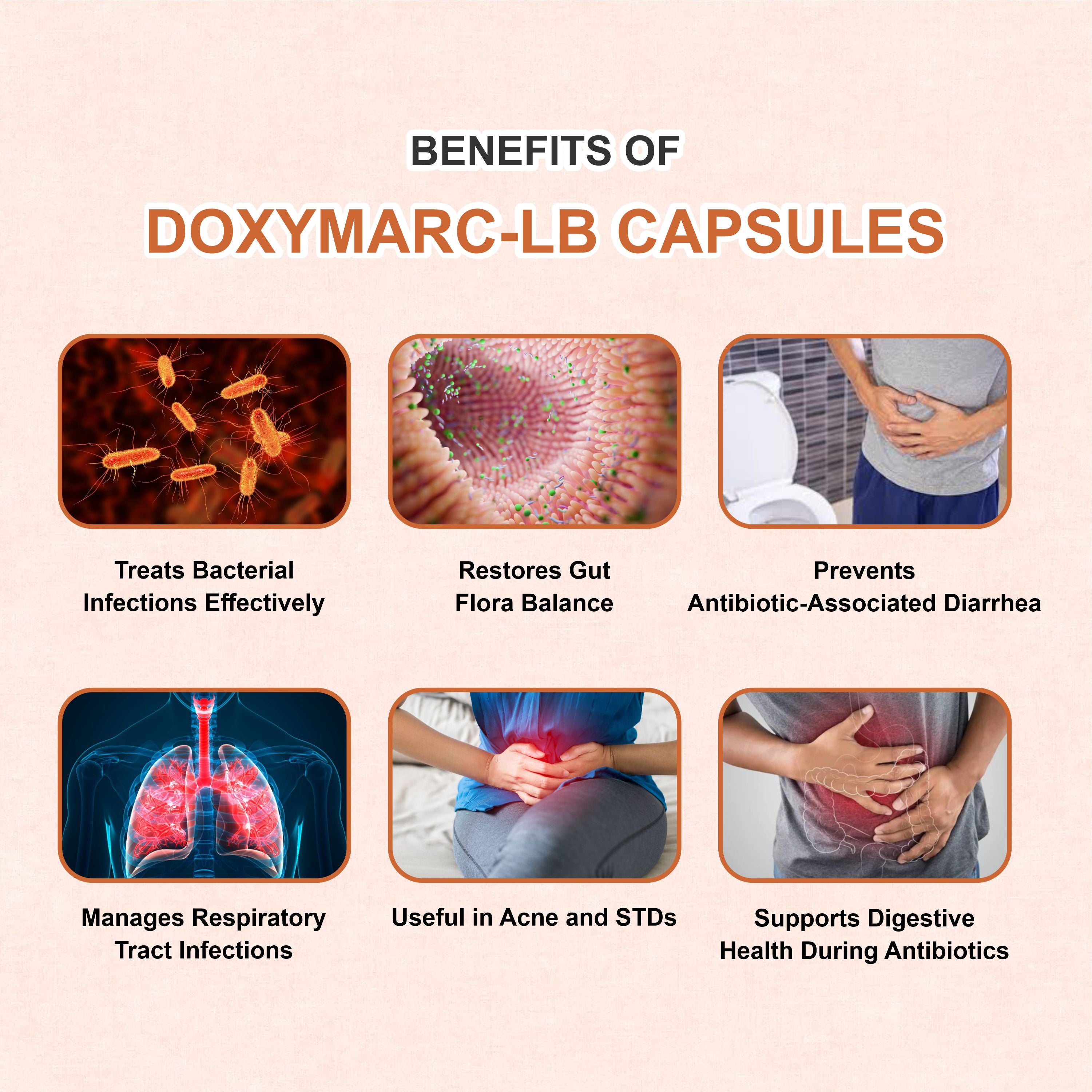 Doxymarc LB Doxycycline & Lactobacillus Capsule – Antibiotic with Gut Protection