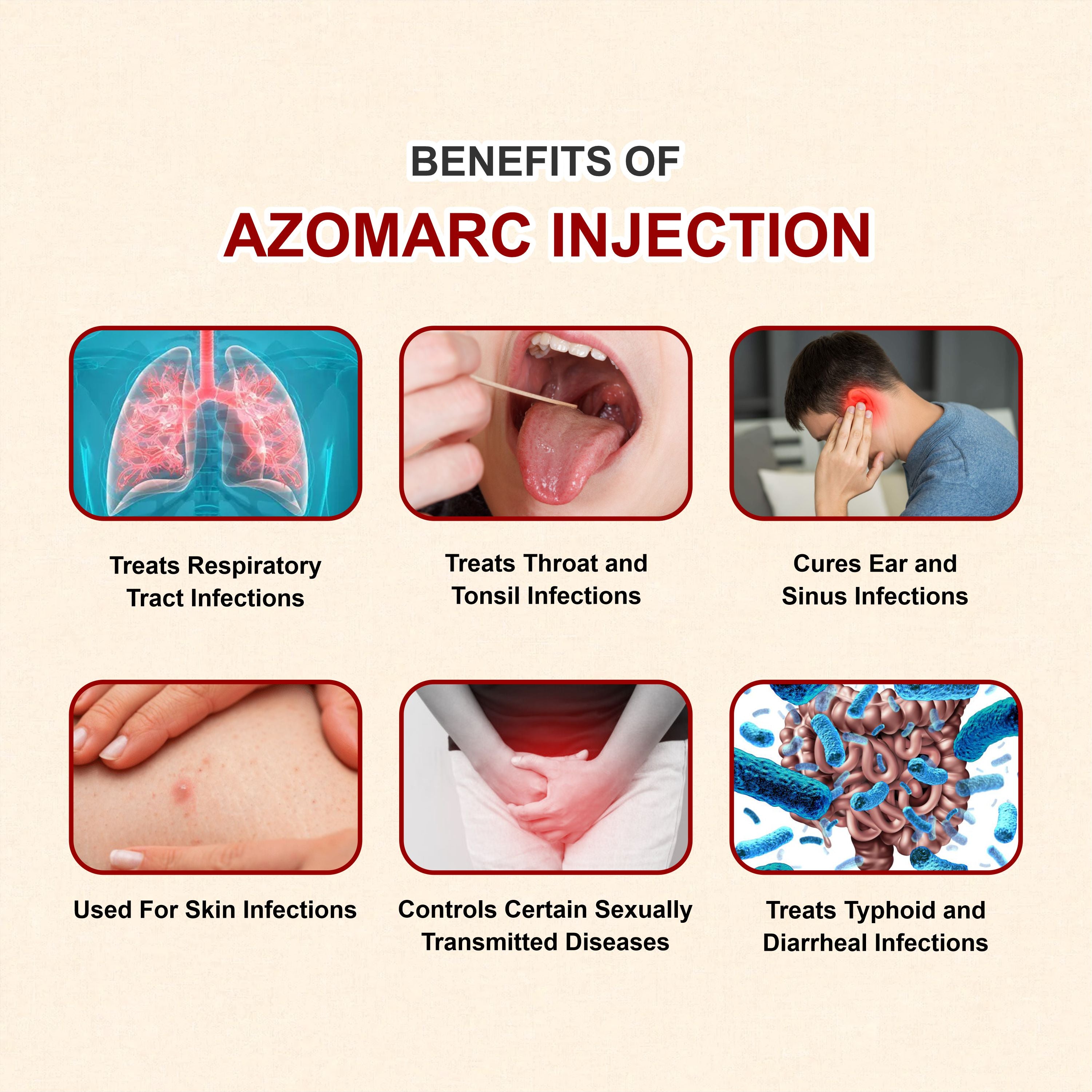 Azomarc Injection (Azithromycin) – Fast-Acting IV Antibiotic for Serious Infections(Pack of 2)
