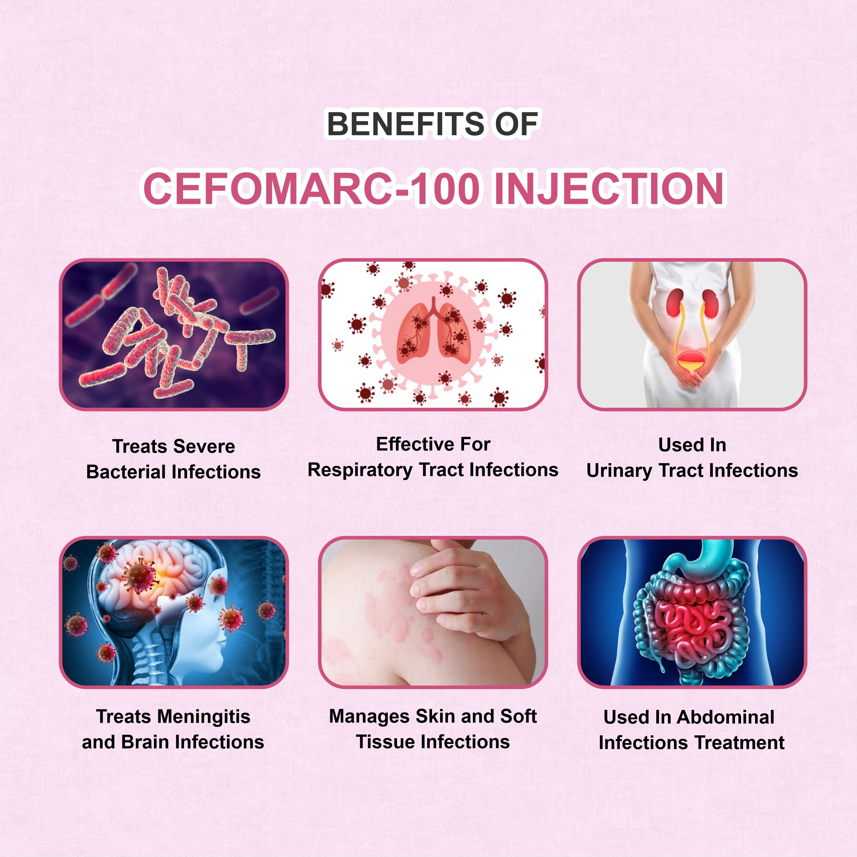 Cefomarc 1000 Injection – Fast-Acting IV Antibiotic for Serious Bacterial Infections (Pack of 6)